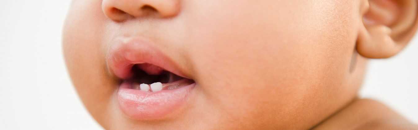 Como aliviar dolor en la dentición del bebé